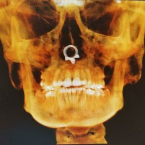 Meet your Posher, Breanne